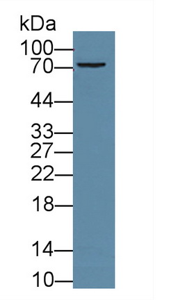 Polyclonal Antibody to Transforming Growth Factor Beta Induced Protein (TGFbI)