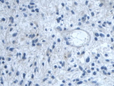 Polyclonal Antibody to Transforming Growth Factor Beta Induced Protein (TGFbI)