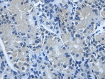 Polyclonal Antibody to Transforming Growth Factor Beta Induced Protein (TGFbI)