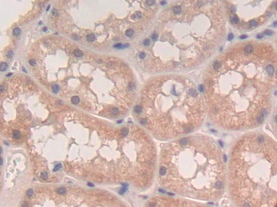 Polyclonal Antibody to Tumor Necrosis Factor Beta (TNFb)