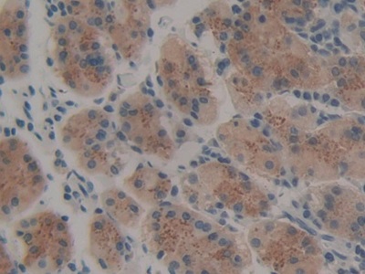 Polyclonal Antibody to Thrombopoietin (TPO)