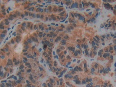 Polyclonal Antibody to Plasminogen Activator, Urokinase Receptor (uPAR)