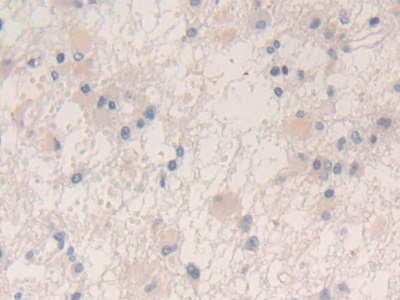 Polyclonal Antibody to Vascular Endothelial Growth Factor A (VEGFA)