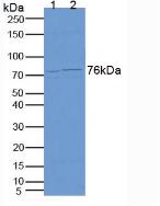 Polyclonal Antibody to Carcinoembryonic Antigen (CEA)