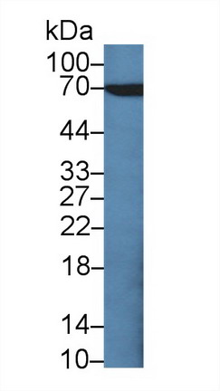 Polyclonal Antibody to Carcinoembryonic Antigen (CEA)