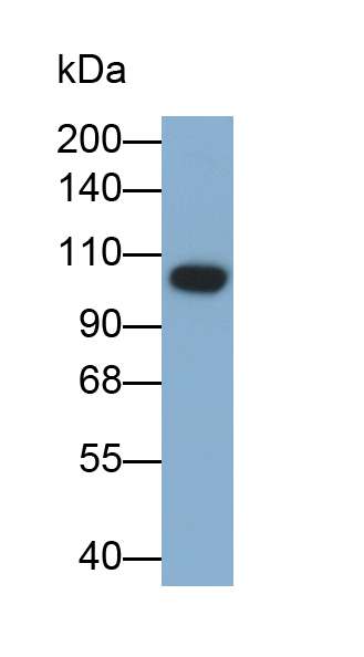 Polyclonal Antibody to Carcinoembryonic Antigen (CEA)
