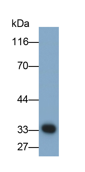 Polyclonal Antibody to Prostate Specific Antigen (PSA)
