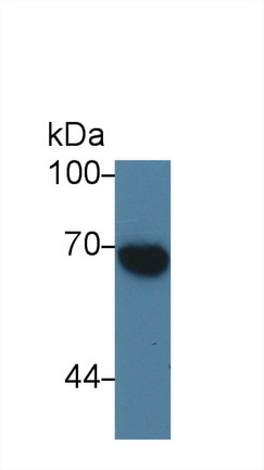 Polyclonal Antibody to Alpha-Fetoprotein (AFP)