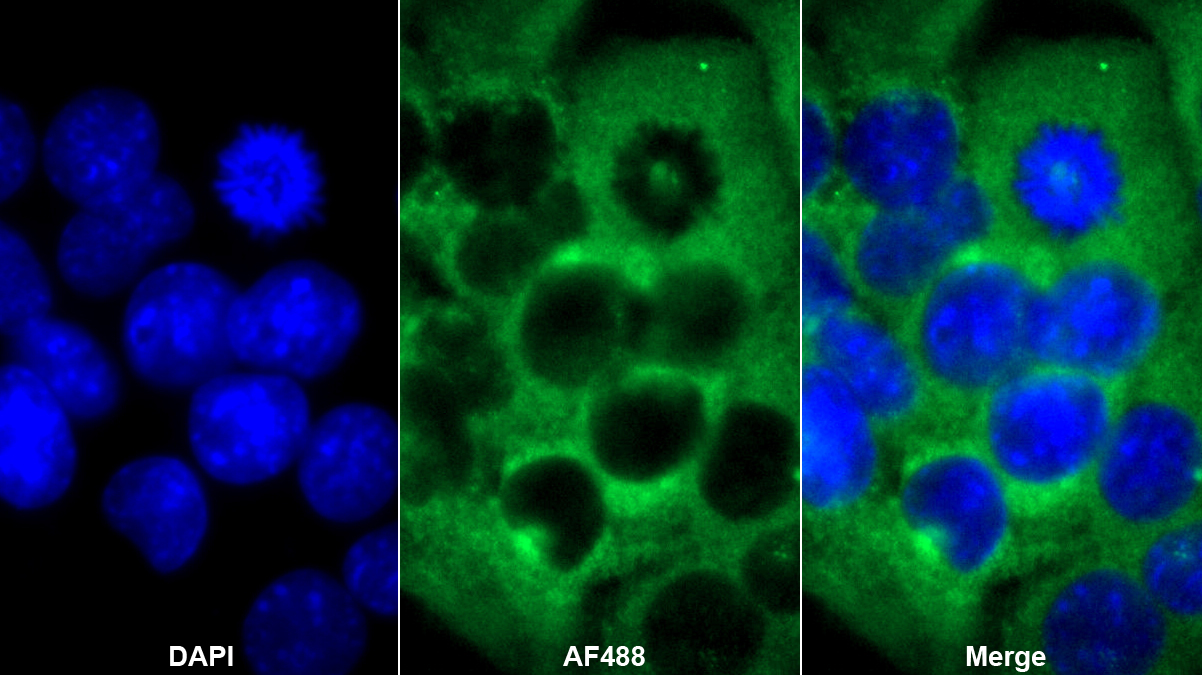 Polyclonal Antibody to Alpha-Fetoprotein (AFP)