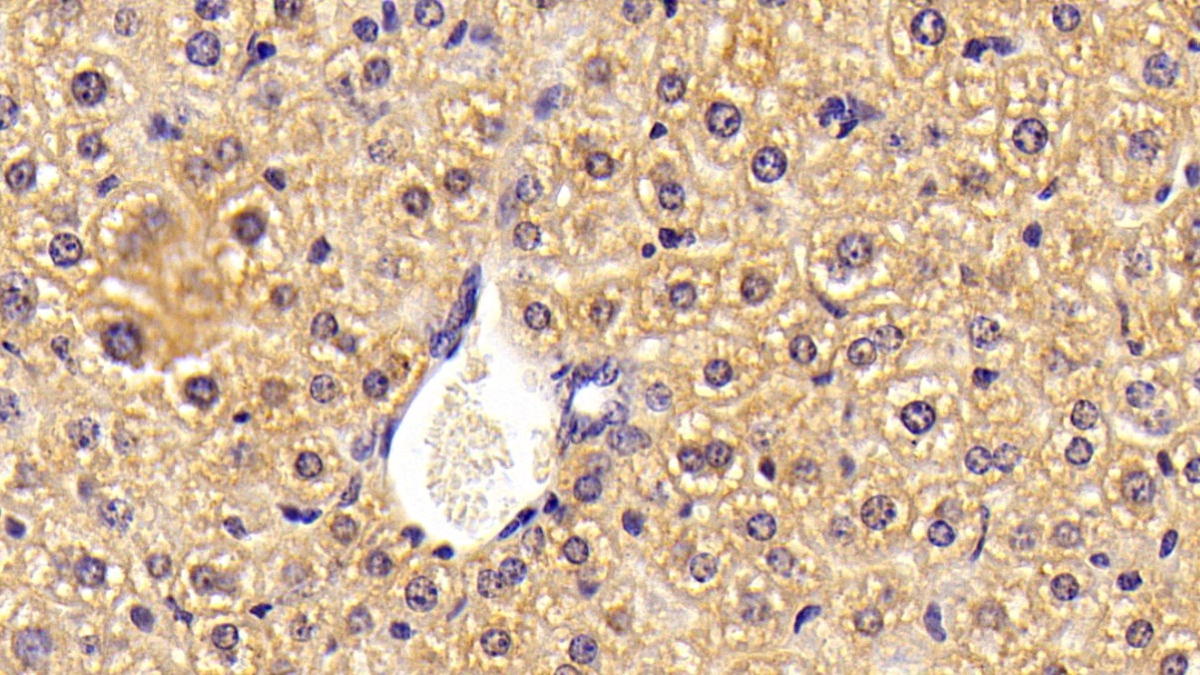 Polyclonal Antibody to Alpha 2-Antiplasmin (a2PI)