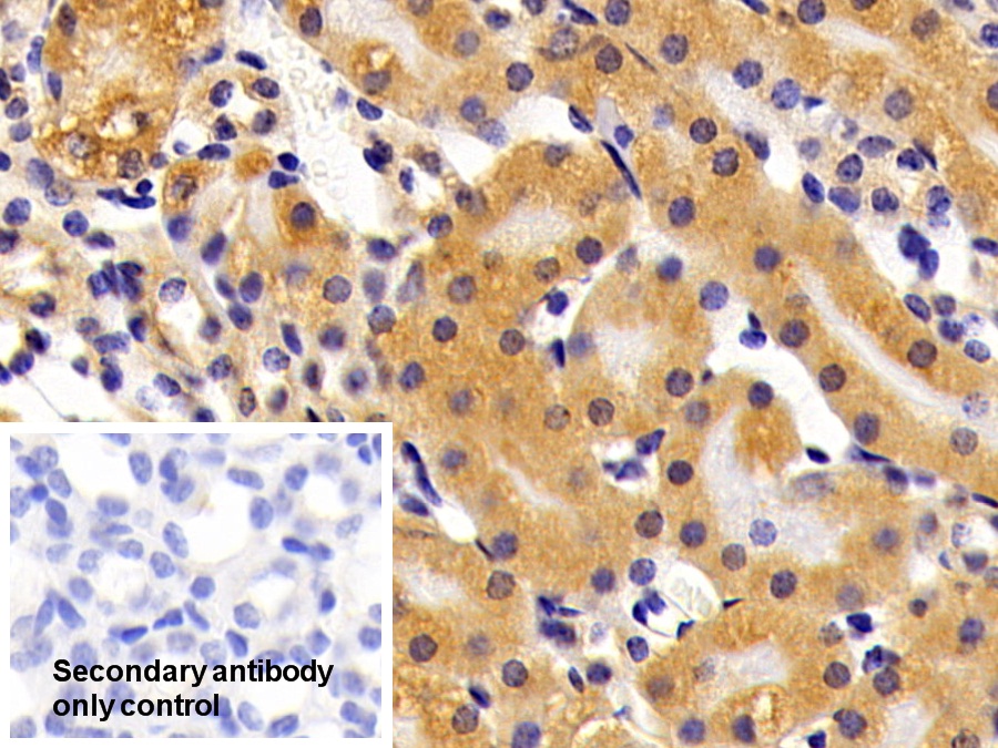 Polyclonal Antibody to Alpha 2-Antiplasmin (a2PI)