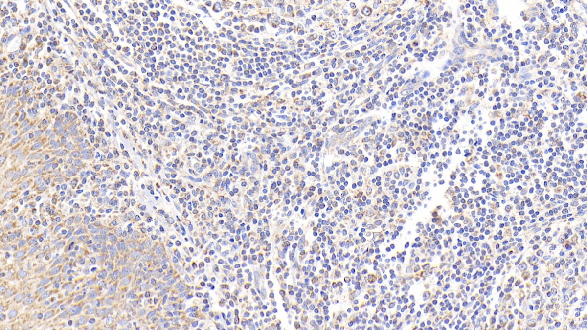 Polyclonal Antibody to Prostaglandin E Synthase, Microsomal (PTGES)