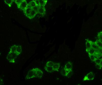 Polyclonal Antibody to Prostatic Acid Phosphatase (PAP)