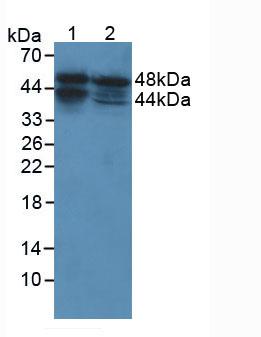 Polyclonal Antibody to Prostatic Acid Phosphatase (PAP)