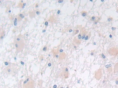 Polyclonal Antibody to Prostatic Acid Phosphatase (PAP)