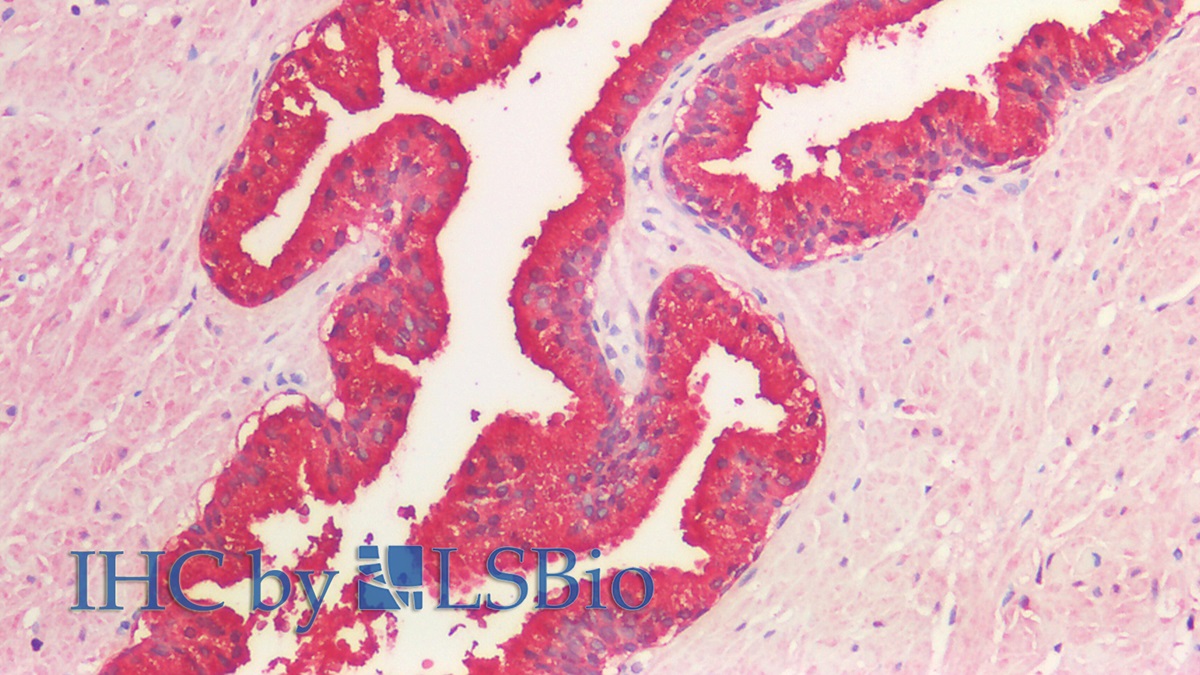 Polyclonal Antibody to Prostatic Acid Phosphatase (PAP)