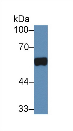 Polyclonal Antibody to Prostatic Acid Phosphatase (PAP)