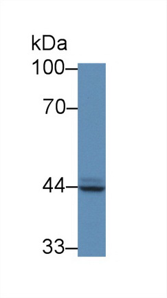 Polyclonal Antibody to Prostatic Acid Phosphatase (PAP)