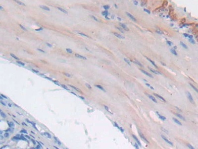 Polyclonal Antibody to Glucosidase Alpha, Acid (GaA)