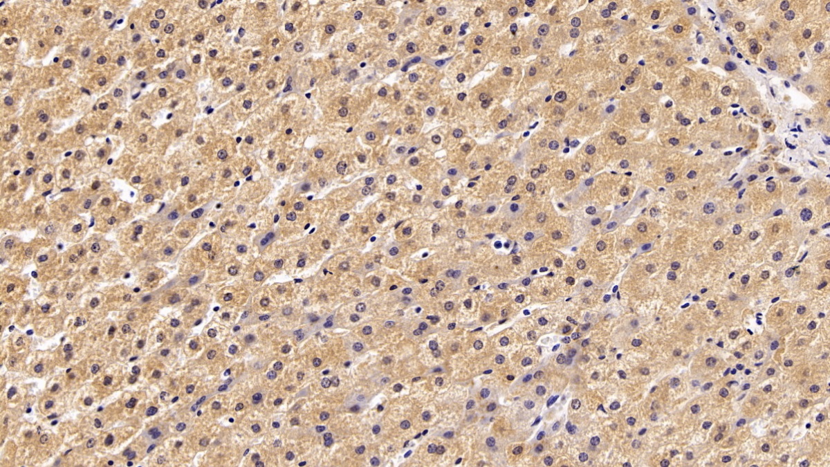 Polyclonal Antibody to Alpha-2-Heremans Schmid Glycoprotein (AHSG)