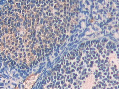 Polyclonal Antibody to Alpha-2-Heremans Schmid Glycoprotein (AHSG)