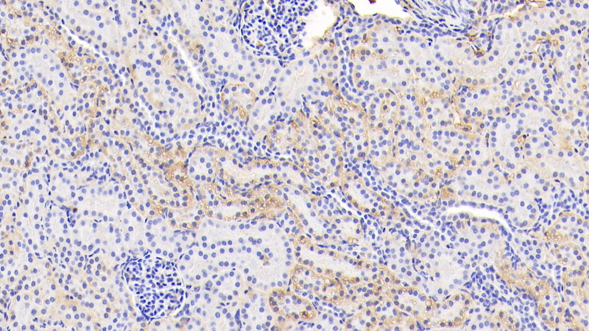 Polyclonal Antibody to Glycated Hemoglobin A1c (HbA1c)