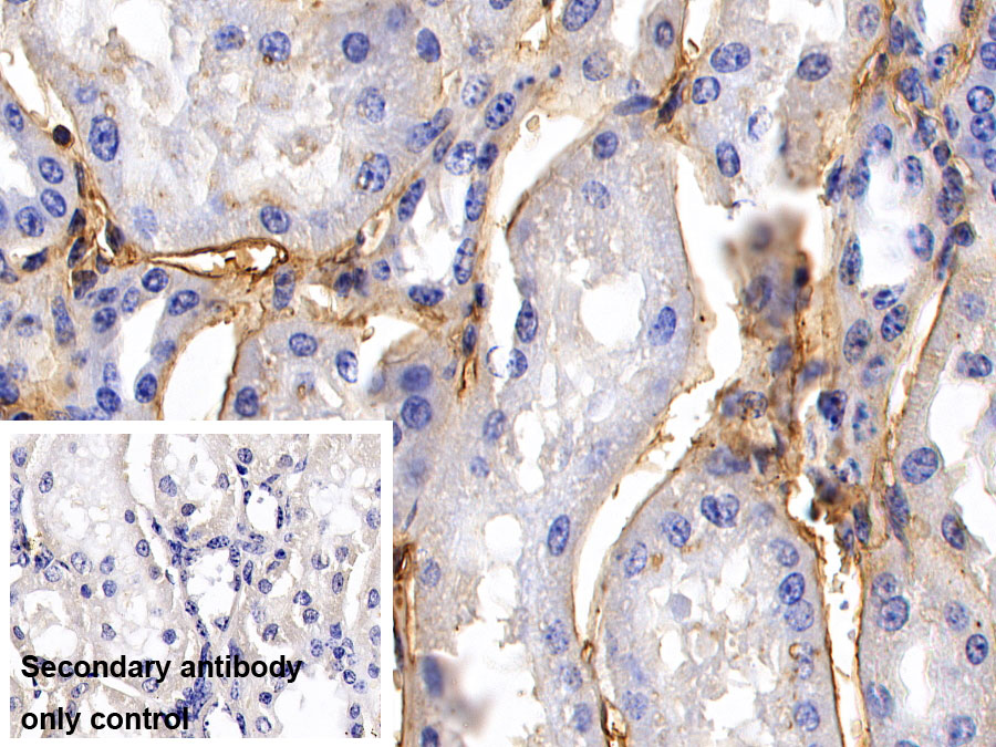 Polyclonal Antibody to Fibrinogen (FG)