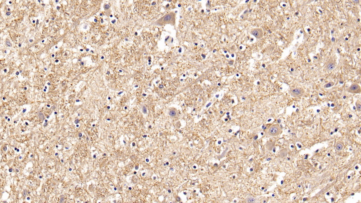 Polyclonal Antibody to Galactosidase Beta (GLb)