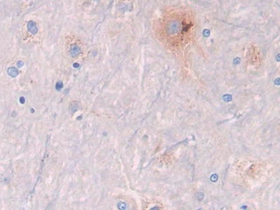 Polyclonal Antibody to Galactosidase Beta (GLb)