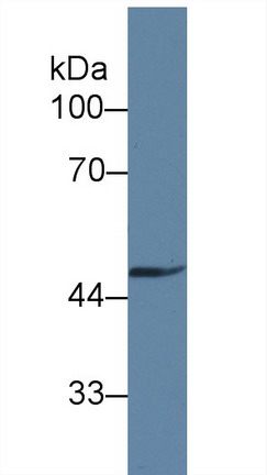 Polyclonal Antibody to Growth Arrest Specific Protein 6 (GAS6)