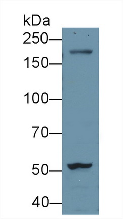 Polyclonal Antibody to Alanine Aminotransferase (ALT)