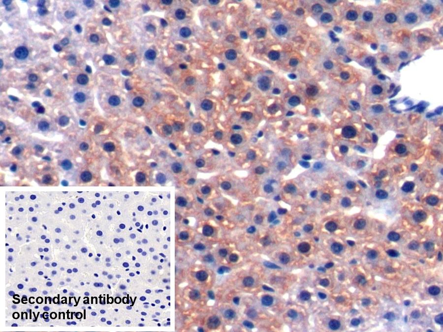 Polyclonal Antibody to Alanine Aminotransferase (ALT)