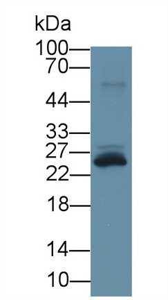 Polyclonal Antibody to Triggering Receptor Expressed On Myeloid Cells 1 (TREM1)