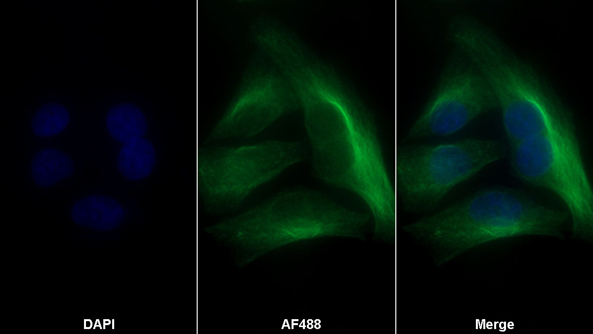 Polyclonal Antibody to Caveolin 1 (CAV1)