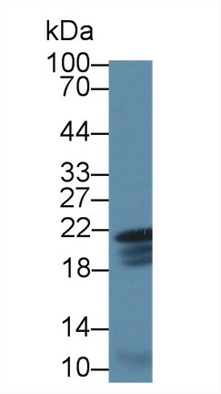 Polyclonal Antibody to Caveolin 1 (CAV1)