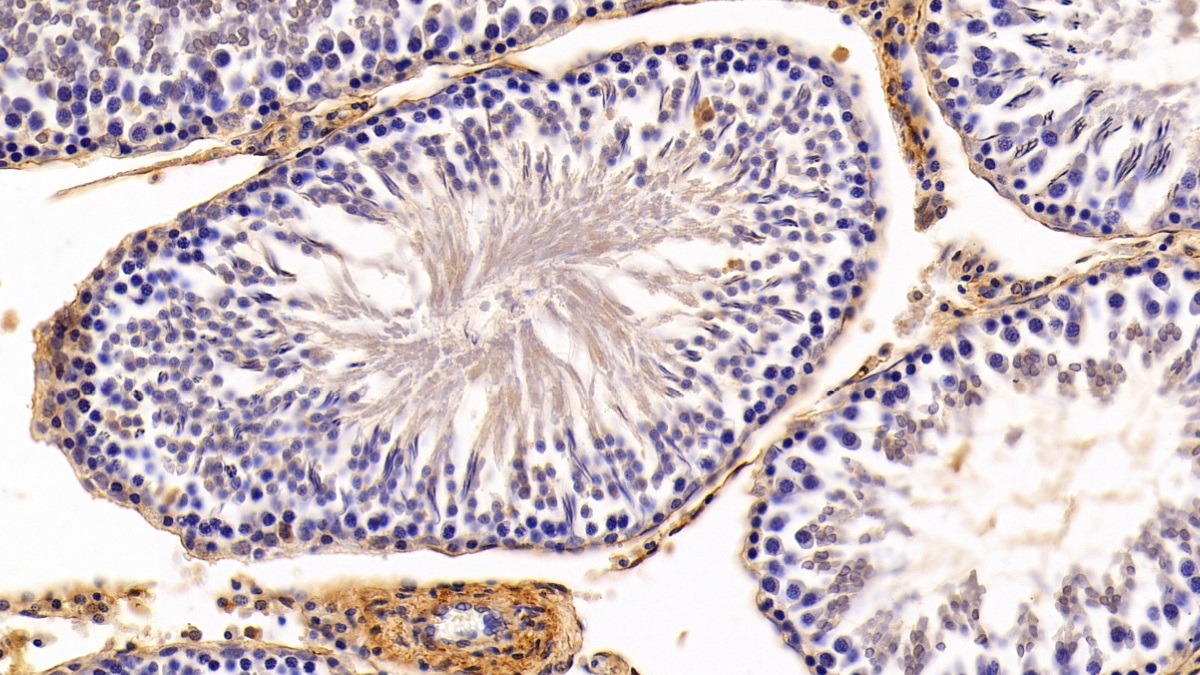 Polyclonal Antibody to Caveolin 1 (CAV1)