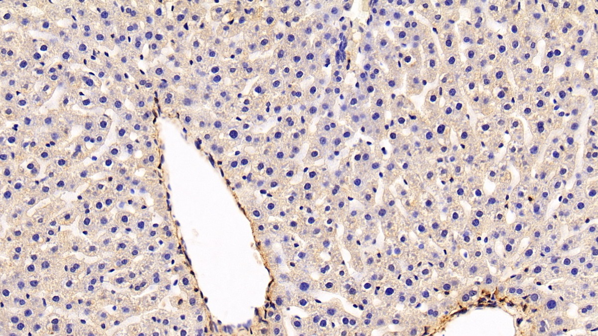 Polyclonal Antibody to Caveolin 1 (CAV1)