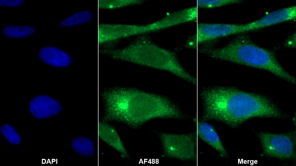 Polyclonal Antibody to Monocyte Chemotactic Protein 4 (MCP4)