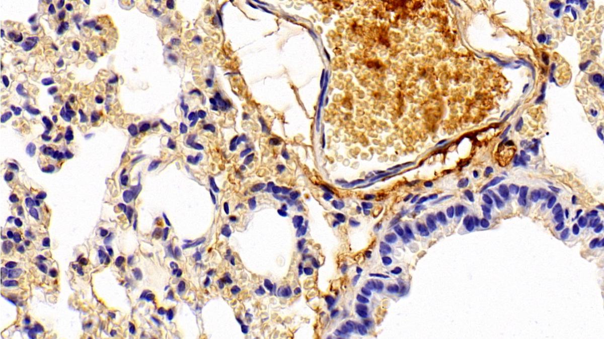 Polyclonal Antibody to Alpha-1-Microglobulin (a1M)