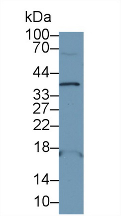 Polyclonal Antibody to Adrenomedullin (ADM)