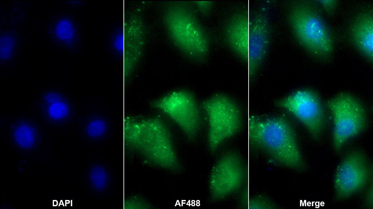 Polyclonal Antibody to Adrenomedullin (ADM)