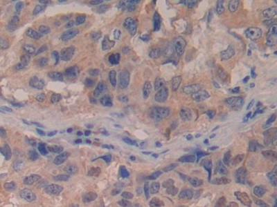 Polyclonal Antibody to Interferon Beta (IFNb)