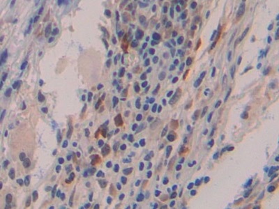 Polyclonal Antibody to Interferon Beta (IFNb)