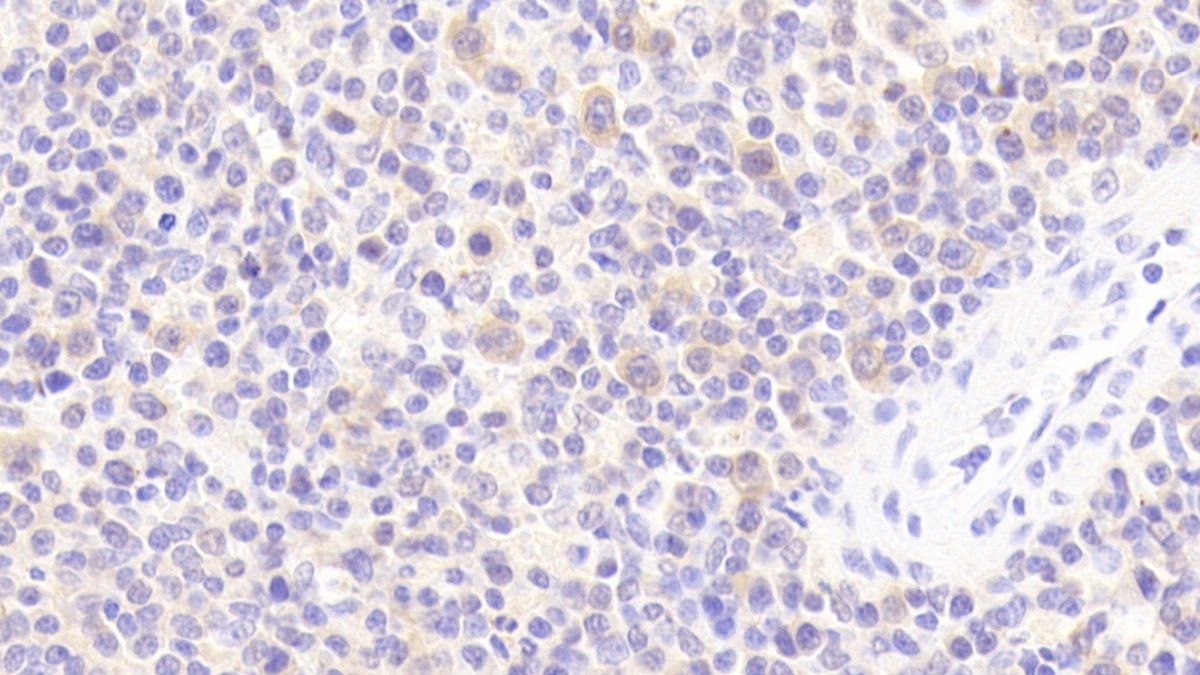 Polyclonal Antibody to Interleukin 1 Receptor Antagonist (IL1RA)