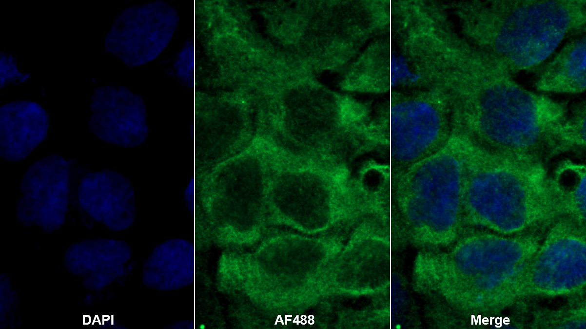 Polyclonal Antibody to Interleukin 1 Receptor Antagonist (IL1RA)
