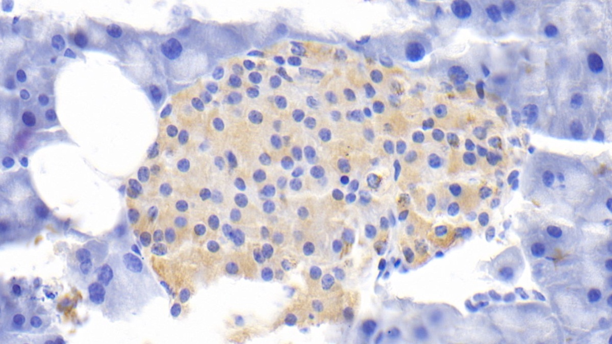 Polyclonal Antibody to Interleukin 1 Receptor Antagonist (IL1RA)