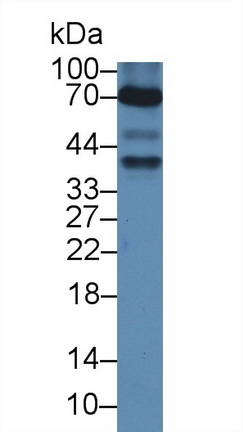 Polyclonal Antibody to Anti-Mullerian Hormone (AMH)