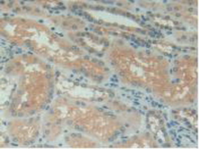 Polyclonal Antibody to Complement 1 Inhibitor (C1INH)