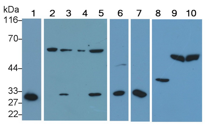 Polyclonal Antibody to Caspase 2 (CASP2)