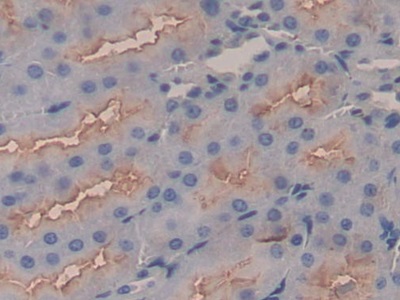 Polyclonal Antibody to Apolipoprotein C1 (APOC1)